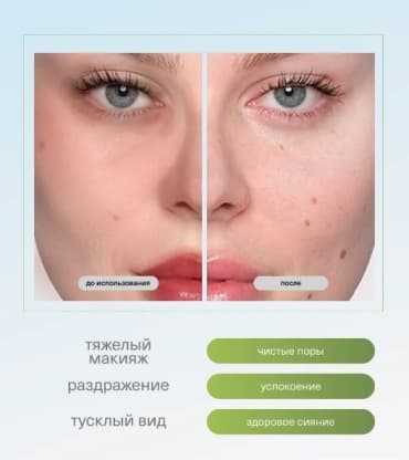 Фото товара 2
